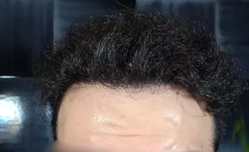 After 